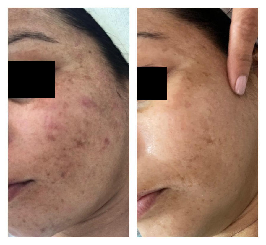 Free HTML5 Bootstrap Template