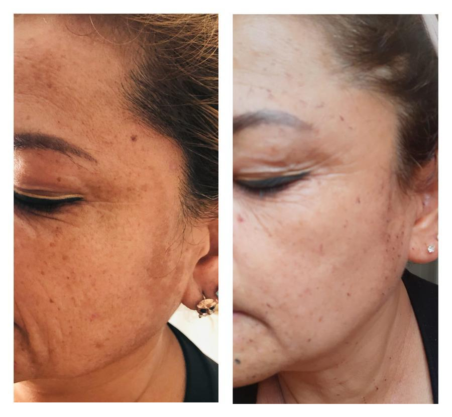 Free HTML5 Bootstrap Template